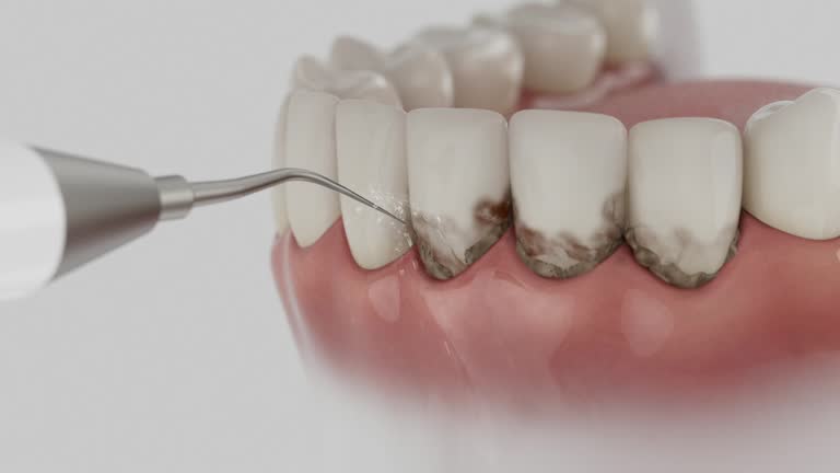 Reliable Dental Implants contractor in Menasha, WI by Smile Center Dentistry